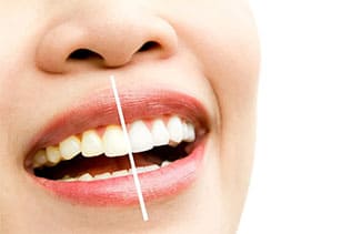علت تغییر رنگ دندان ها چیست؟