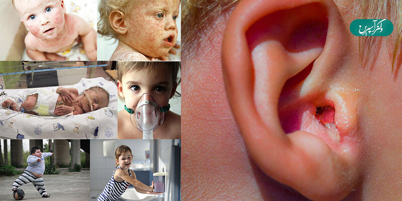 انواع بیماری های رایج کودکان کدامند؟