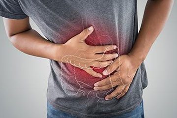 سندروم روده تحریک پذیر