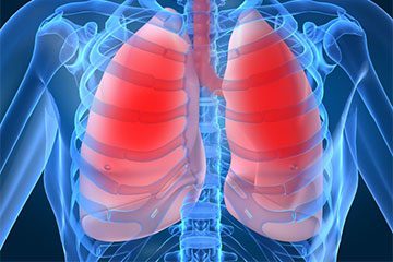 آب آوردن ریه چگونه اتفاق میفتد ؟