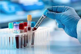 چکاپ کامل شامل چه آزمایش هایی می شود