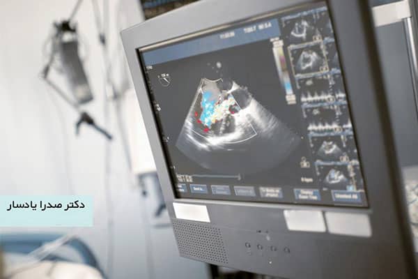 مطب دکتر صدرا یادسار متخصص قلب و عروق