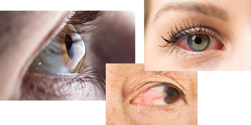 متخصص چشم چه بیماریهایی را درمان می کند