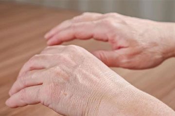لرزش دست چیست ؟