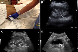 سونوگرافی کبد