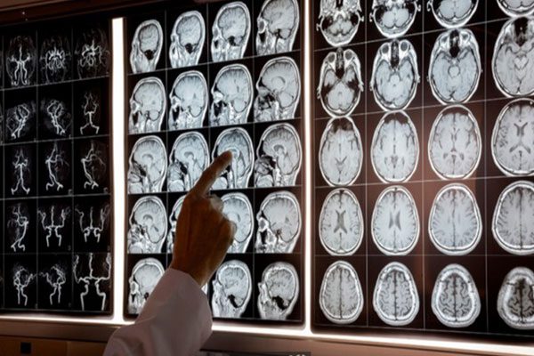 مطب کترمحمد جواد متخصص مغز واعصاب