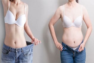جراحی های زیبایی بعد از زایمان